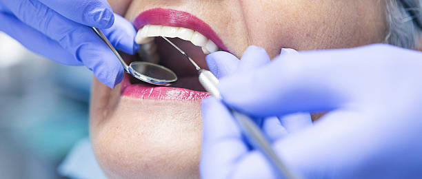 Best Broken or Chipped Tooth Repair in Camilla, GA